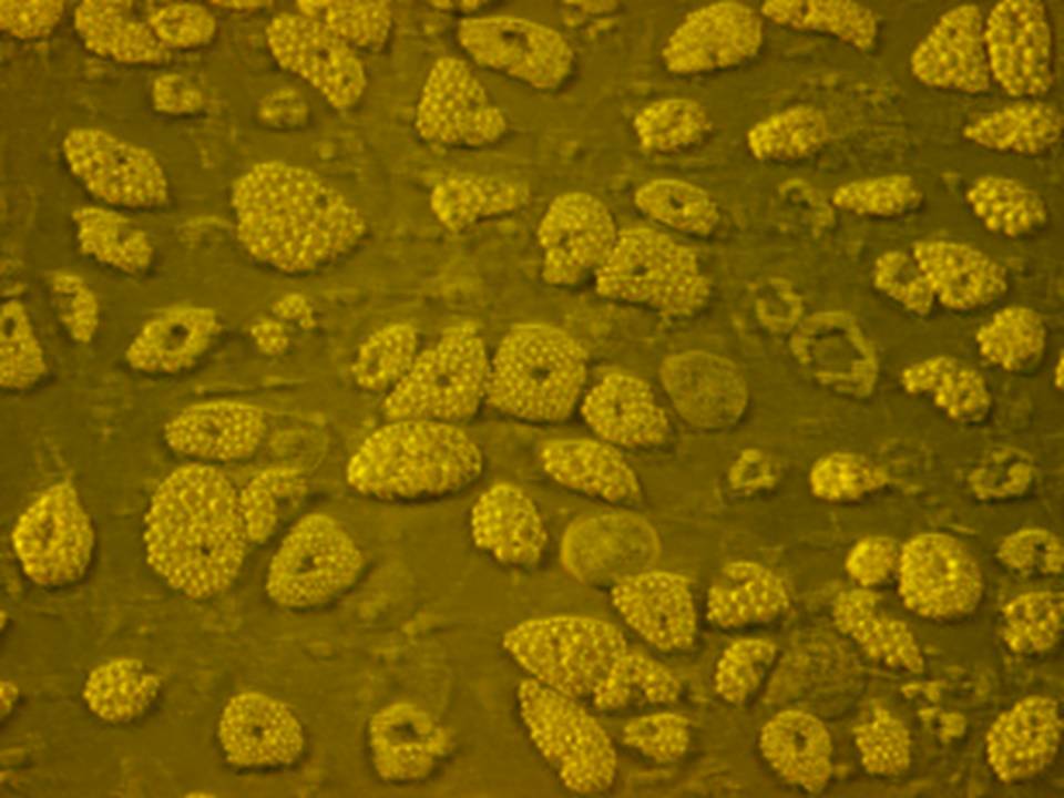Bright-field image.jpg Bright-field image.jpg