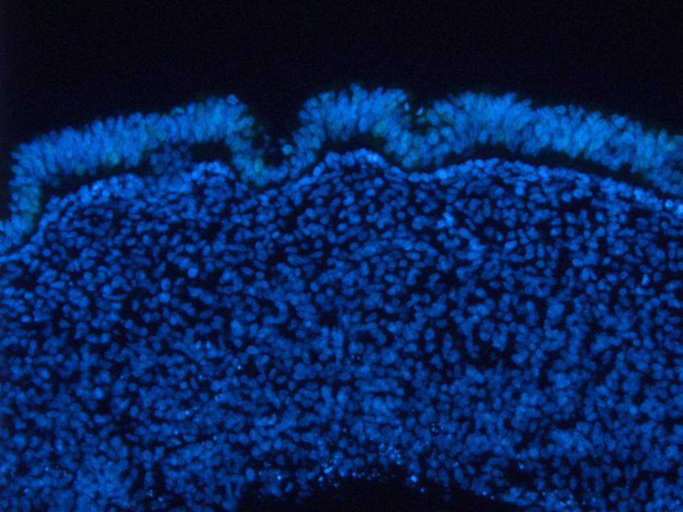 DAPI staining of the explant