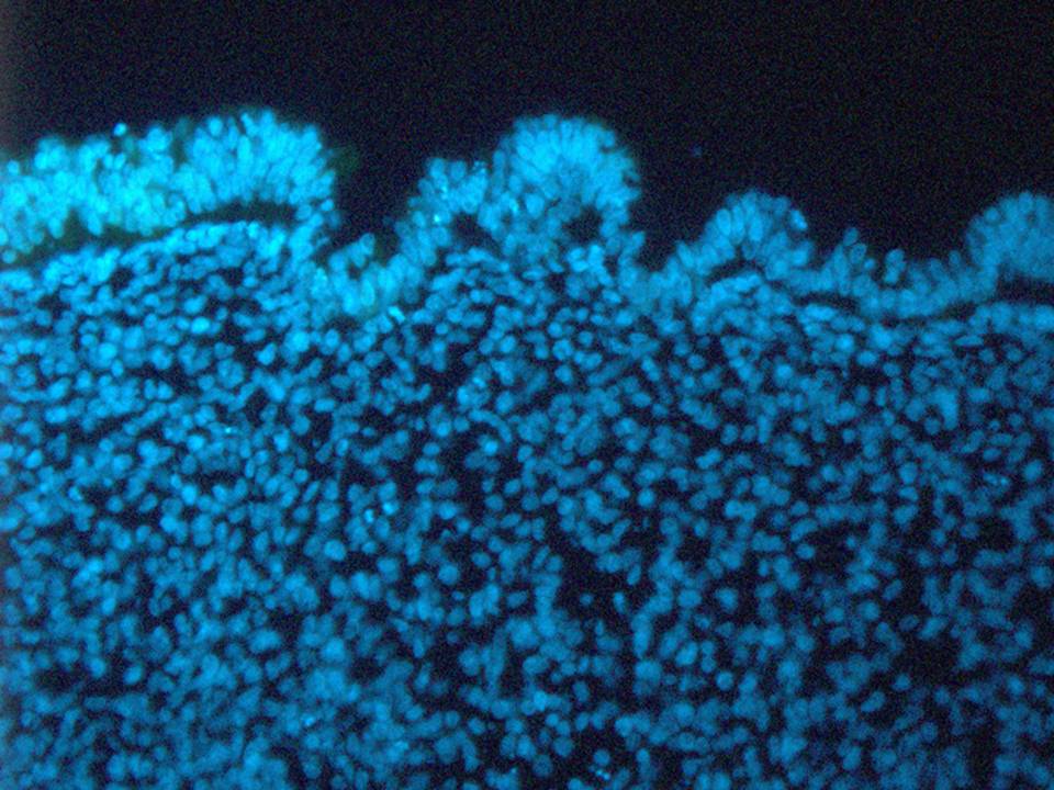 DAPI staining of the explant