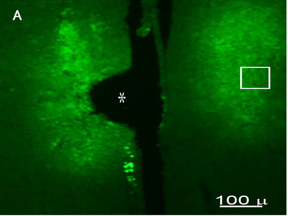 EGFP expression in the medial preoptic nuclei of a female rat EGFP expression in the medial preoptic nuclei of a female rat
