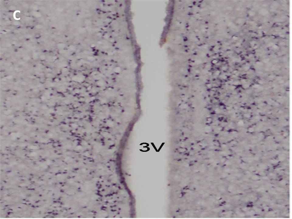 Estrogen receptor α immunoreactivity in the medial preoptic nuclei and the periventricular nuclei of an adult female rat Estrogen receptor α immunoreactivity in the medial preoptic nuclei and the periventricular nuclei of an adult female rat