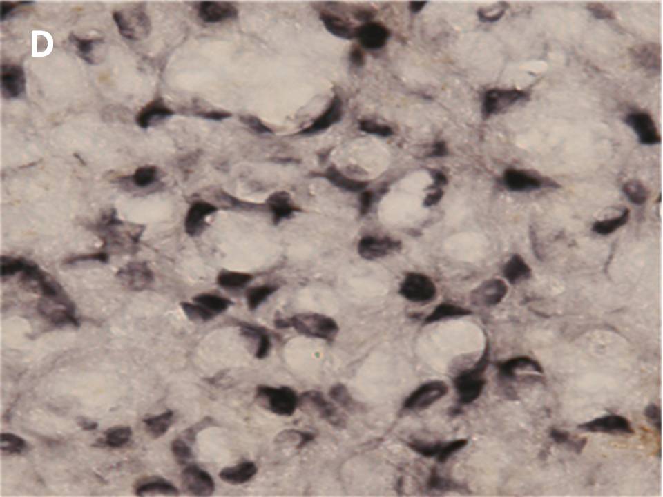 Estrogen receptorα-positive cells Estrogen receptorα-positive cells