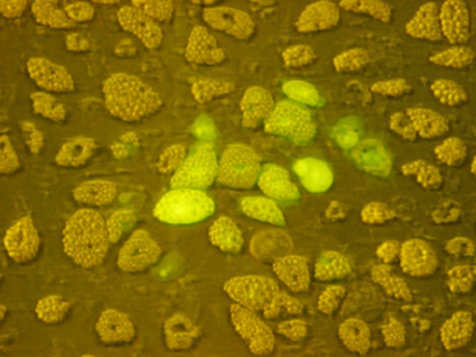 Fluorescence and bright-field image Fluorescence and bright-field image