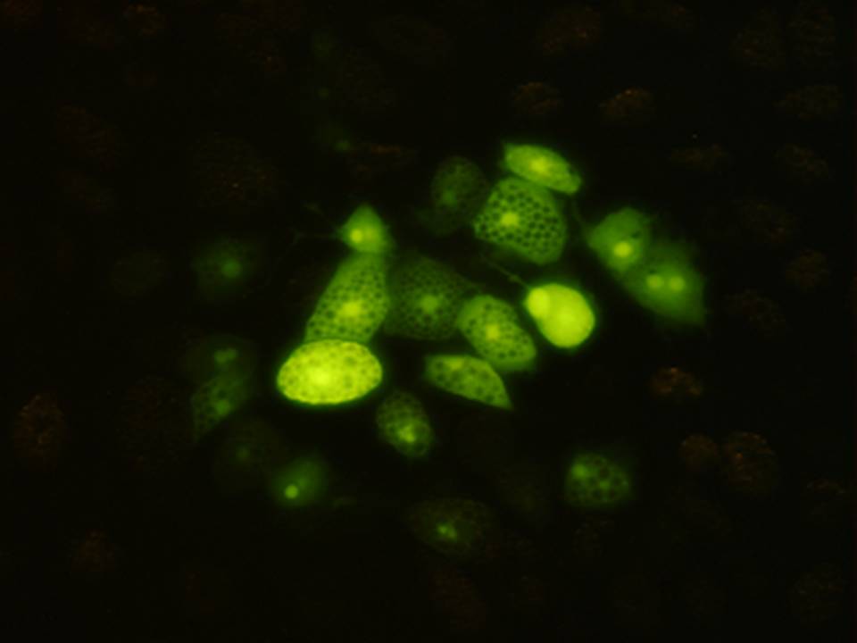 Fluorescence image Fluorescence image