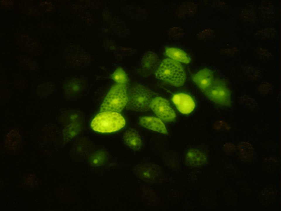 Fluorescence image