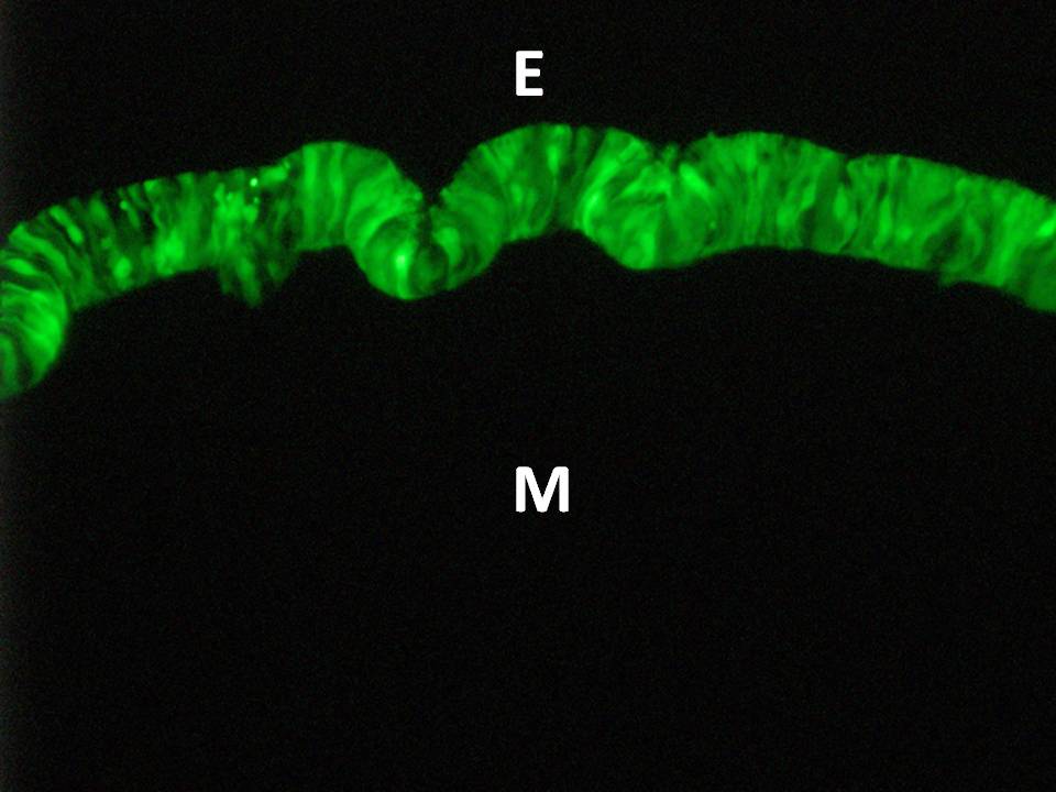 GFP expression in the epithelium
