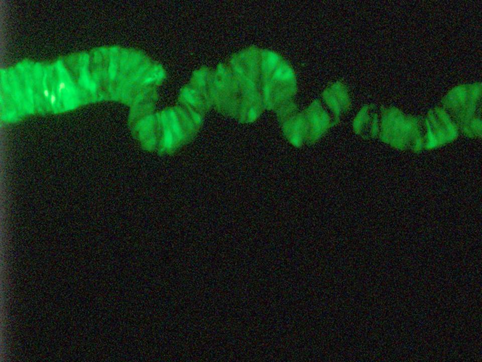 GFP expression epithelium2