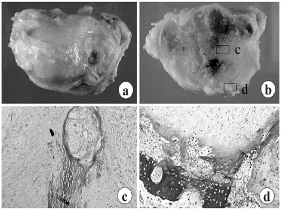 Gross and microscopic results.jpg