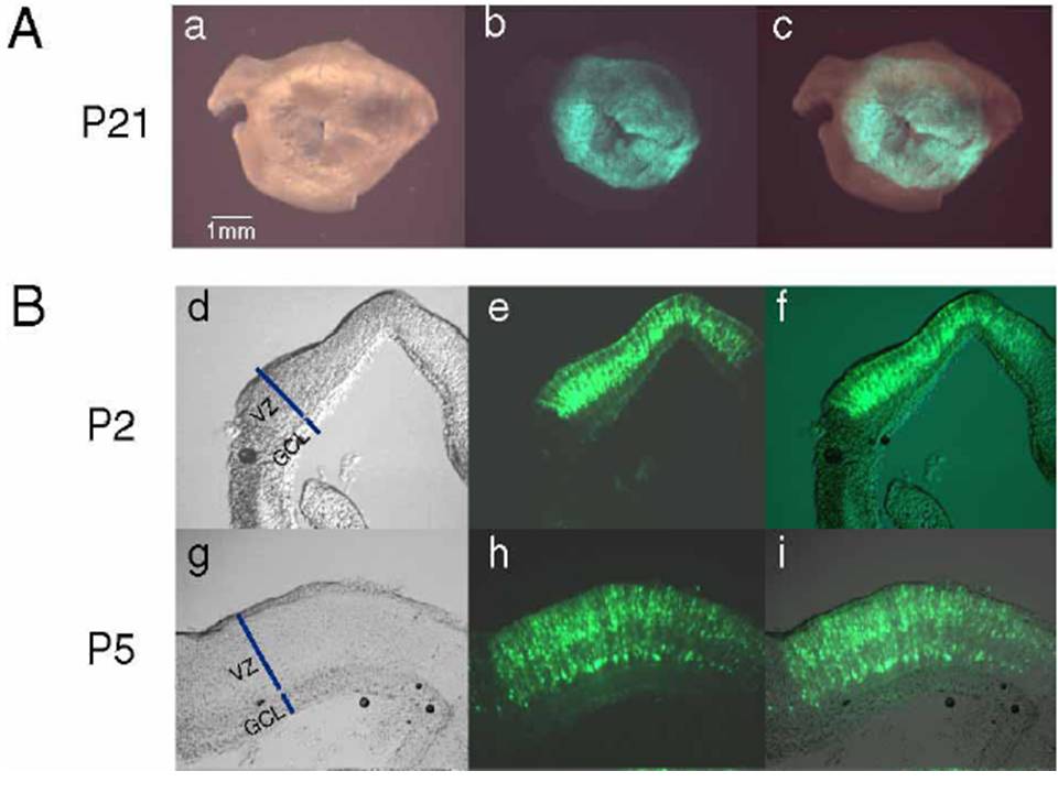 In vivo electroporated rat retinae harvested at various developmental stages
