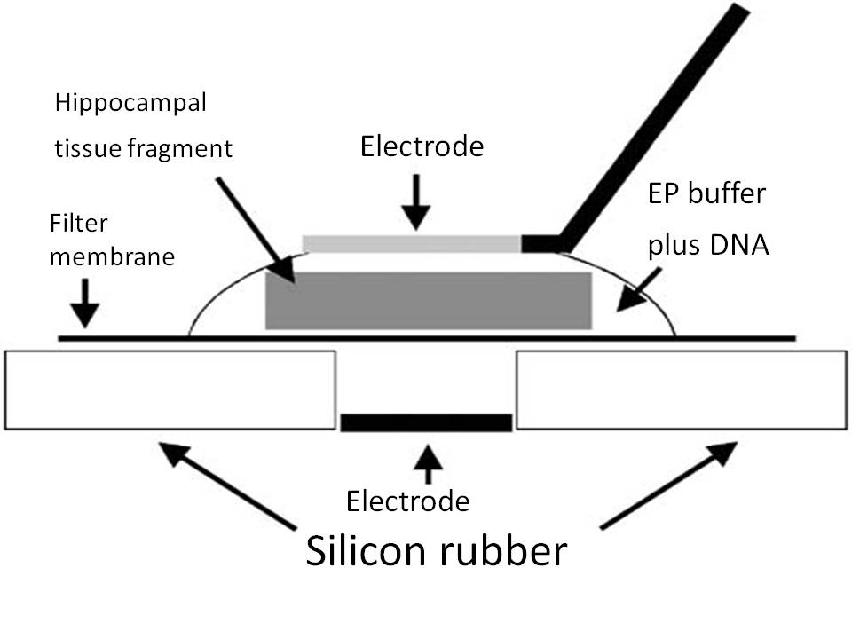 Schematic representation of an electroporation set-up