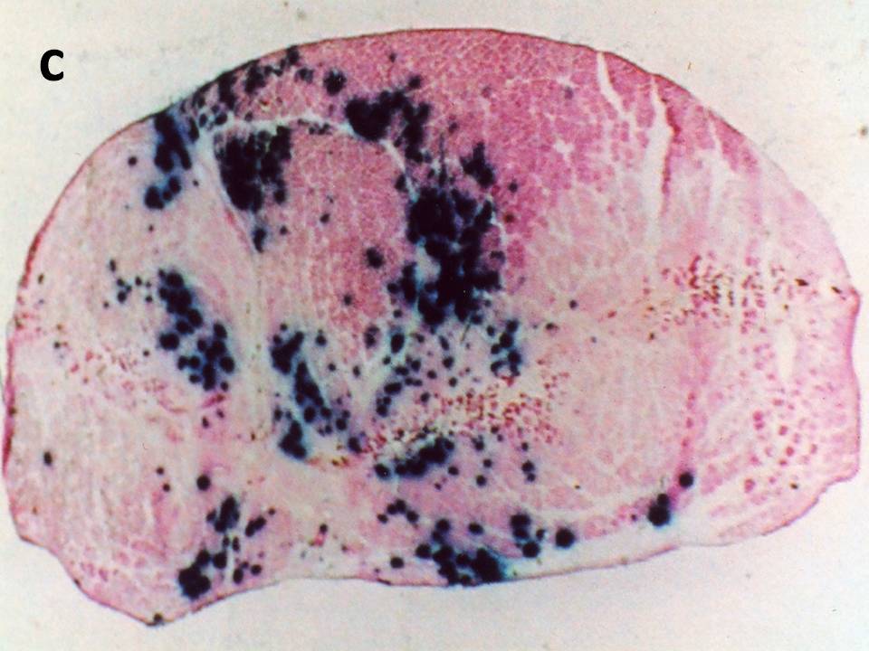 Transverse section with EP Transverse section with EP