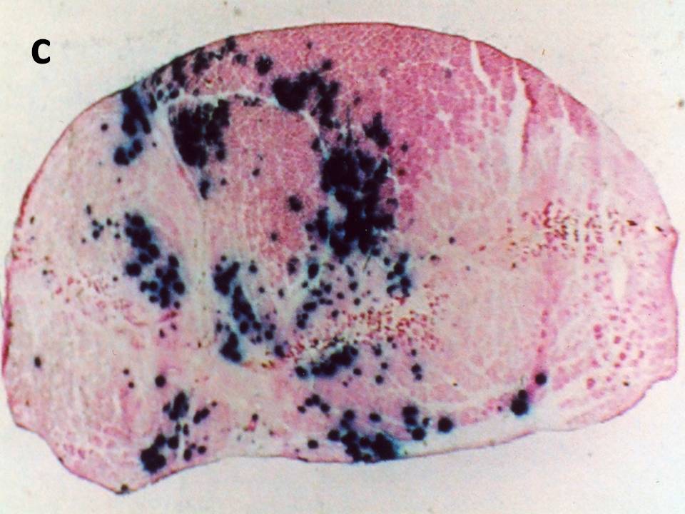 Transverse section with EP