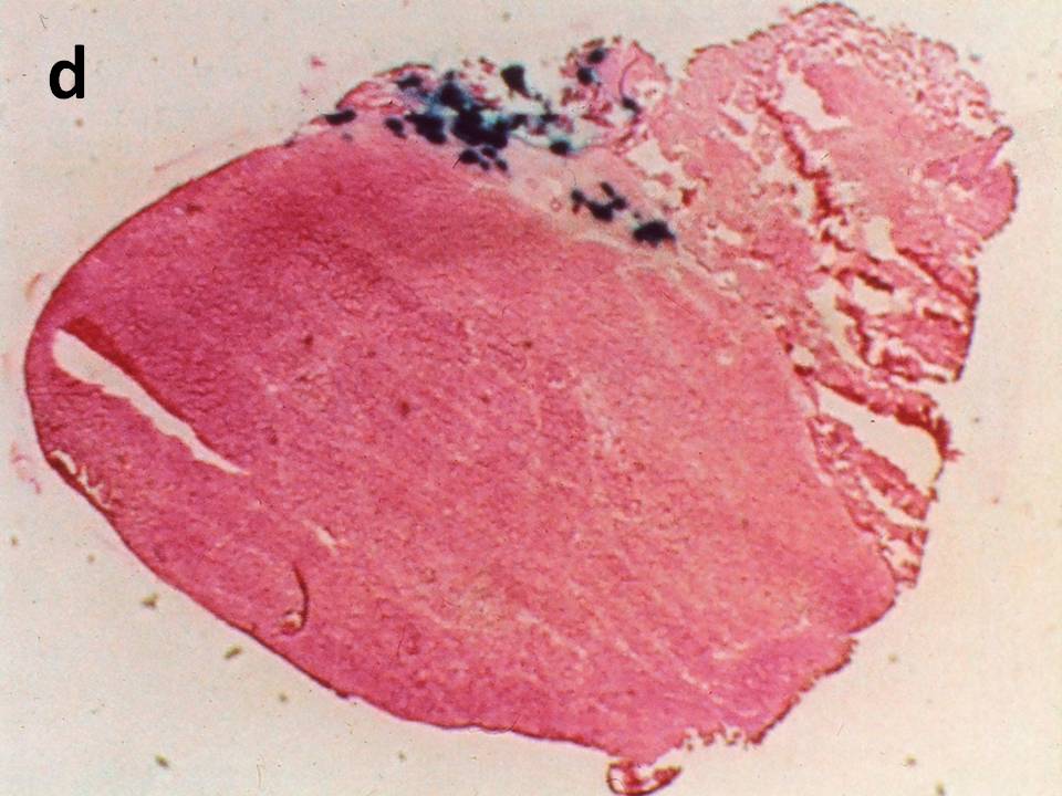 Transverse section without EP