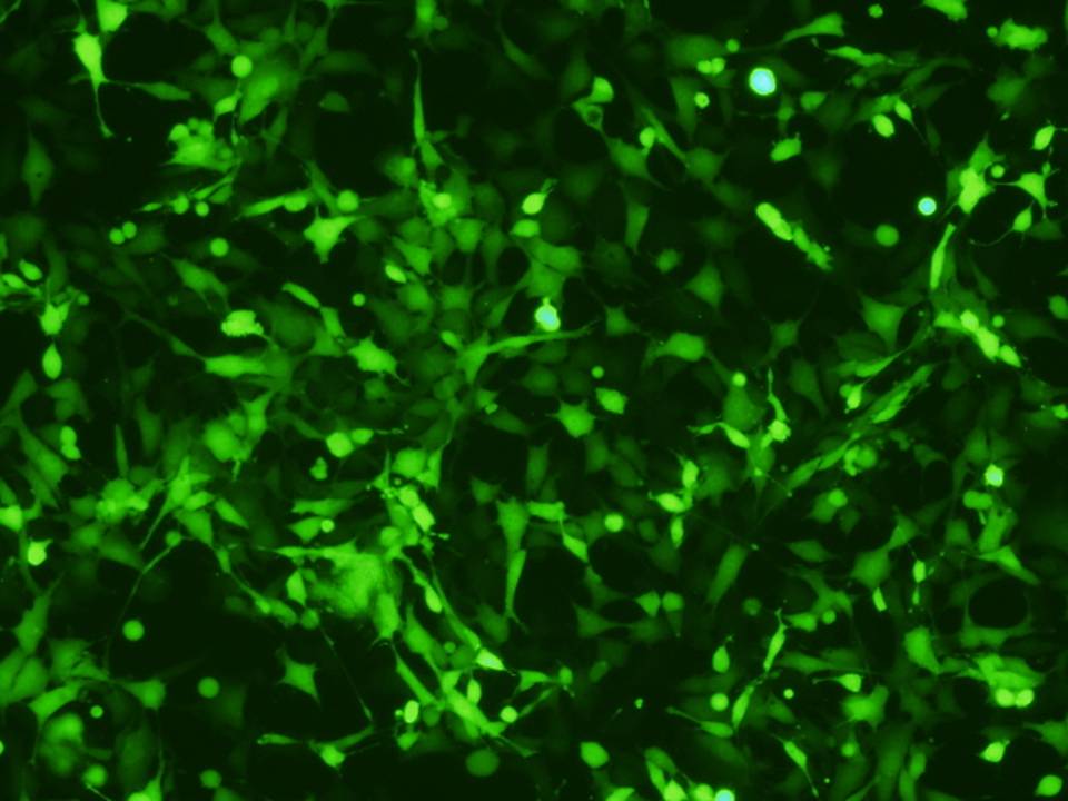 NEPA21 / 3T3-L1 - Mouse Preadipocytes - Transfection Efficiency 90 per cent