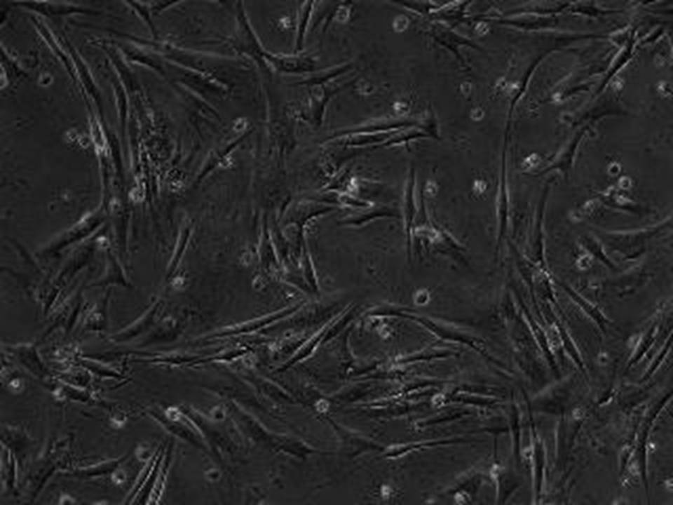 NEPA21 / CCD1079sk - Human Skin Fibroblasts - Viability 40 per cent