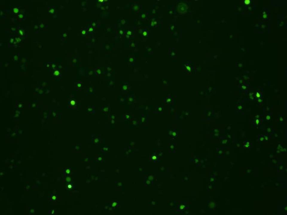 NEPA21 / DT40 - Chicken B cells - Transfection Efficiency 40 per cent