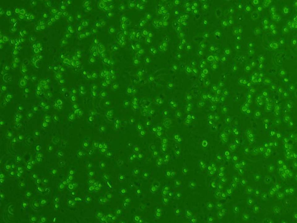 NEPA21 / DT40 - Chicken B cells - Viability 38 per cent