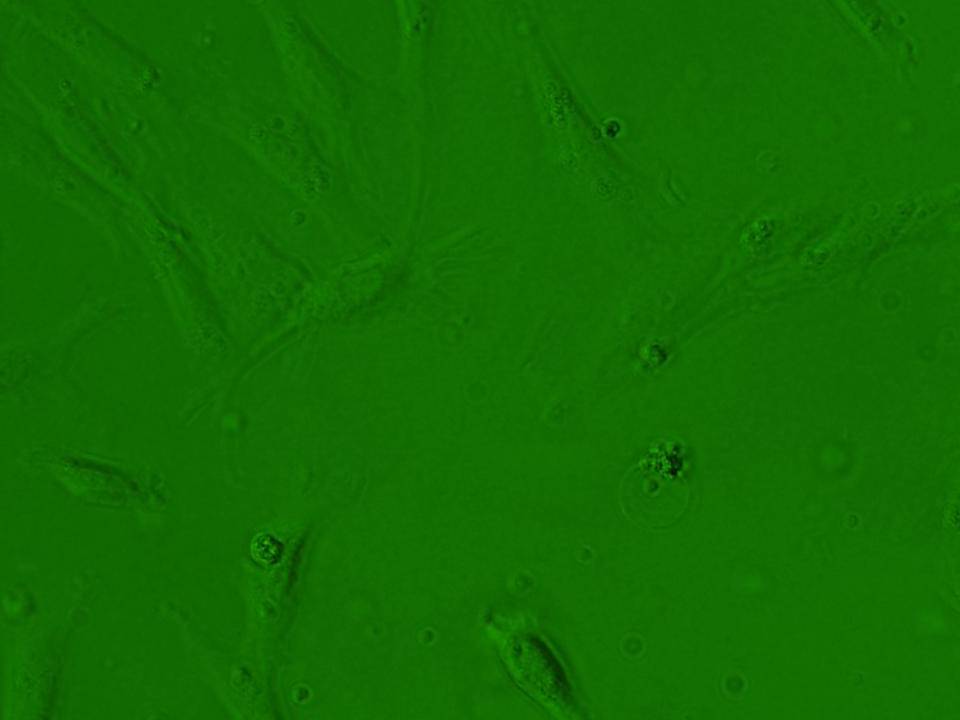 NEPA21 / GTS9 - Ginbuna Thymus cells - Viability 50 per cent