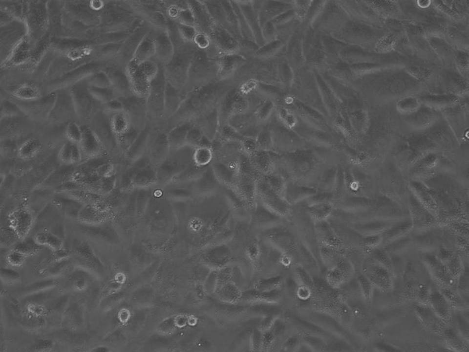 NEPA21 / H9c2 - Rat Ventricular Myoblasts - Viability 71 per cent
