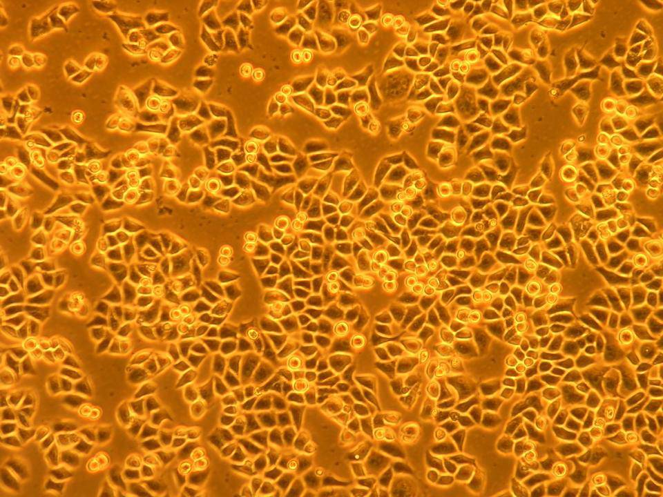 NEPA21 / HeLa - Human Cervical Carcinoma cells - Viability 95 per cent.jpg