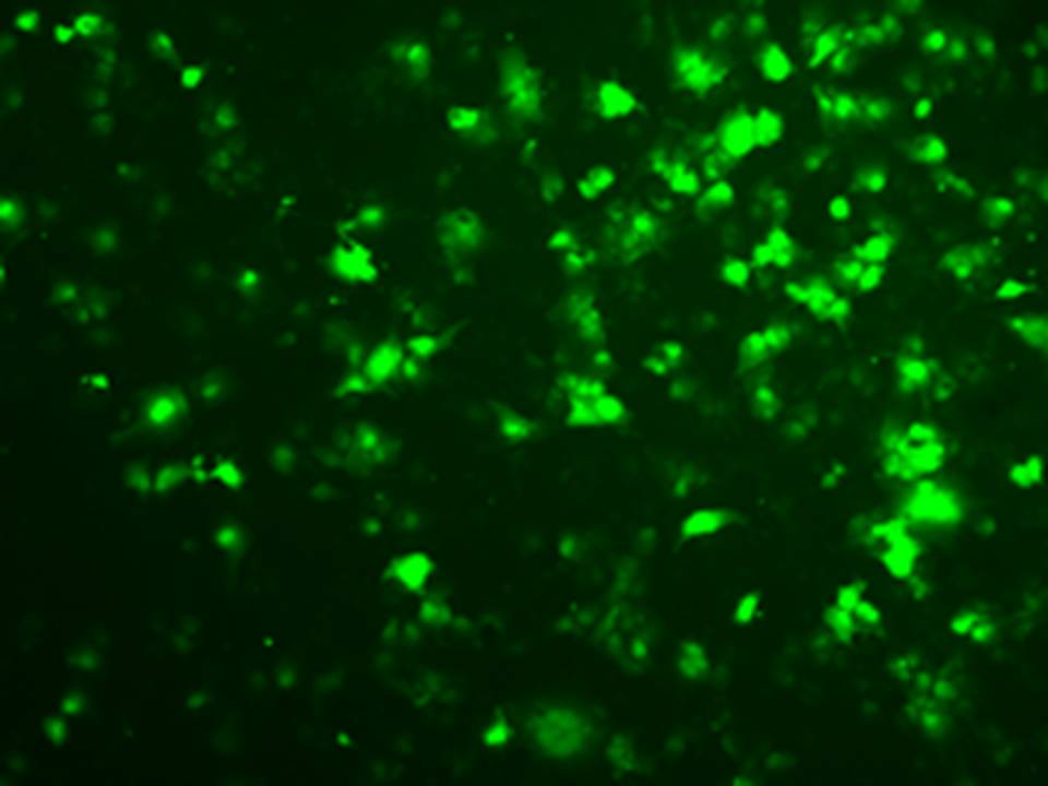 NEPA21 / HuH-7 - Human Hepatoma cells - Transfection Efficiency: Good