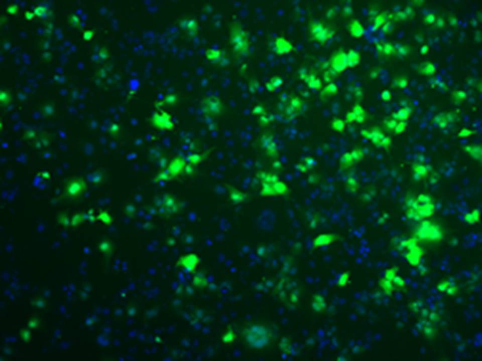 NEPA21 / HuH-7 - Human Hepatoma cells - Viability 70 per cent