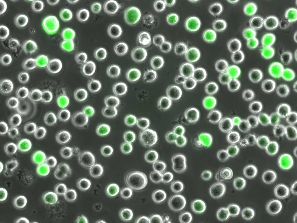 NEPA21 / K562 - Human Erythroleukemia cells - Transfection Efficiency 99 per cent