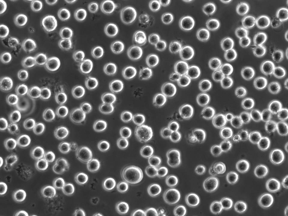 NEPA21 / K562 - Human Erythroleukemia cells - Viability 91 per cent