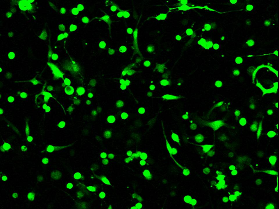 NEPA21 / KG-1-C - Human Oligodendroglial cells - Transfection Efficiency 60 per cent