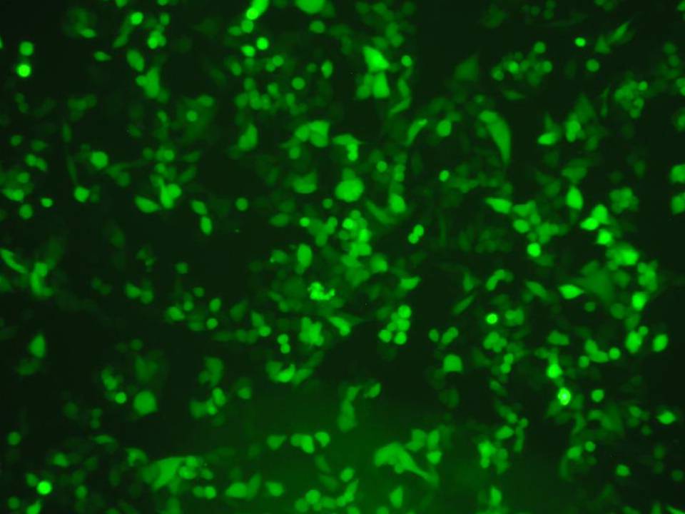 NEPA21 / MIA-PaCa-2 - Human Pancreatic Carcinoma cells - Transfection Efficiency 77 per cent