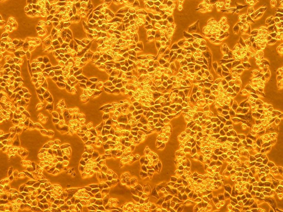 NEPA21 / MIA-PaCa-2 - Human Pancreatic Carcinoma cells - Viability 80 per cent