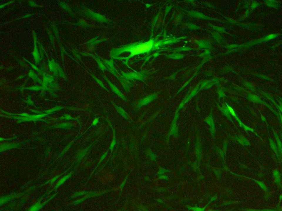 NEPA21 / MRC-5 - Human Embryonic Lung Fibroblasts - Transfection Efficiency 90 per cent