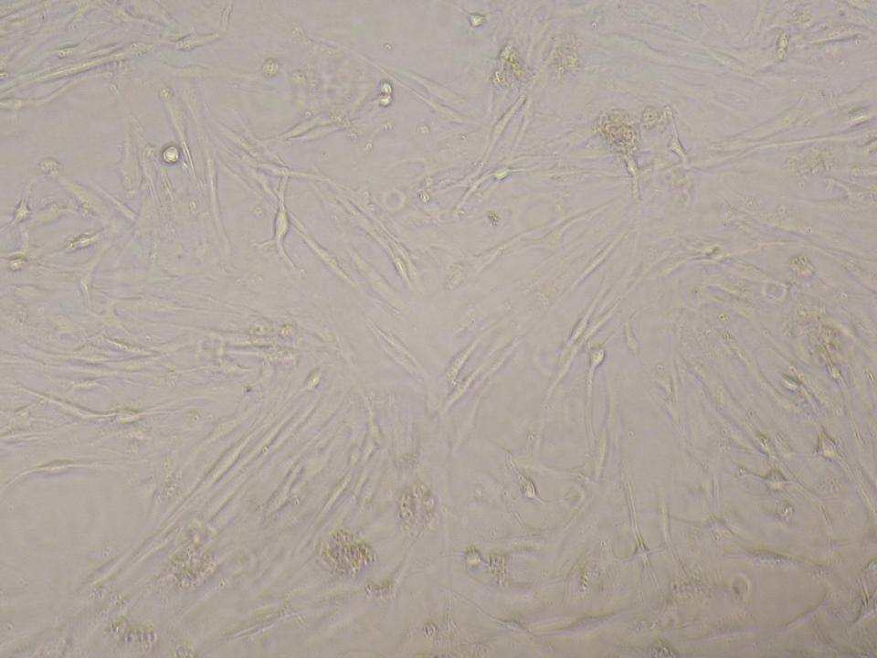 NEPA21 / MRC-5 - Human Embryonic Lung Fibroblasts - Viability 85 per cent