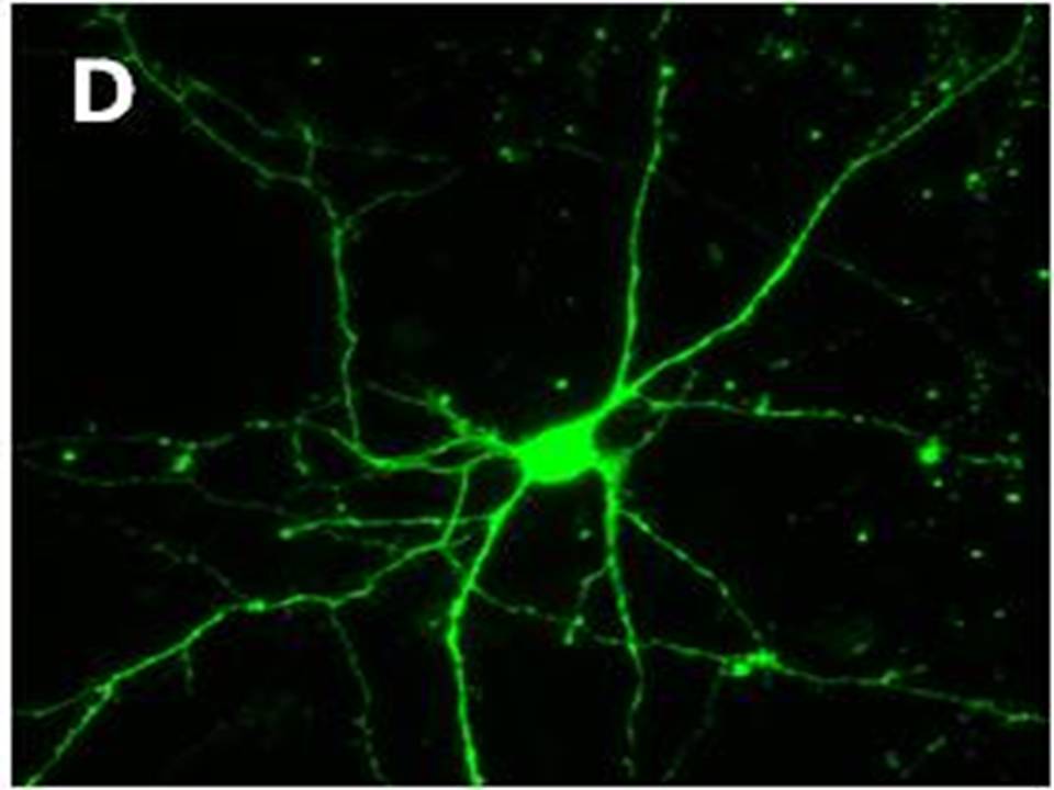 High magnification image of Figure C (x40). (Neurites are clearly visible).