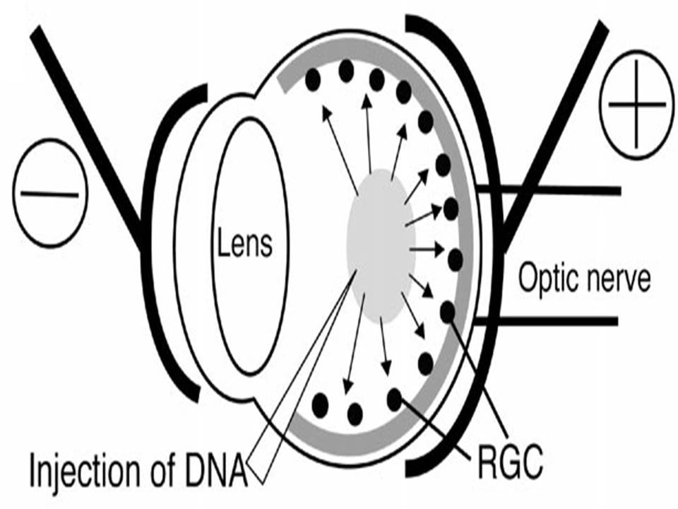 Diagram1