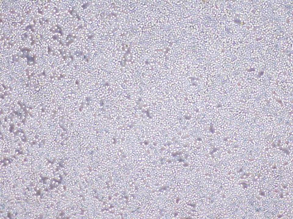 Neuro-2a - Mouse Neuroblastoma cells - Viability 90 per cent