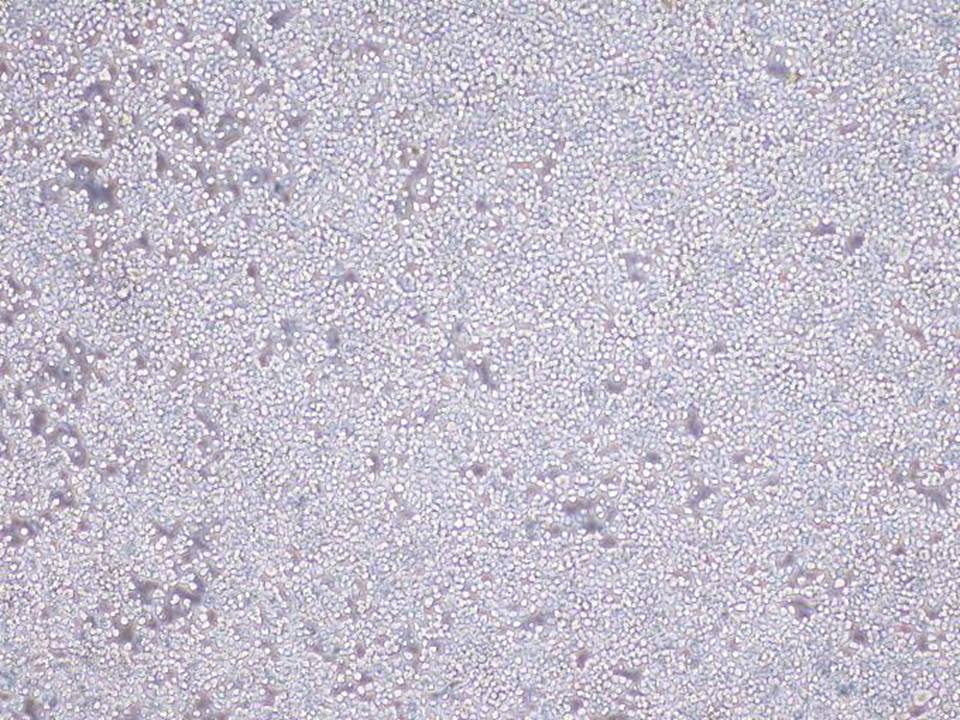 Neuro-2a - Mouse Neuroblastoma cells - Viability 90 per cent