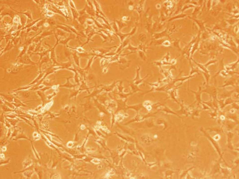 NEPA21 / Primary MEF - Mouse Embryonic Fibroblasts - Viability 90 per cent