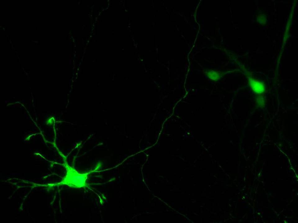 Primary Mouse Neurons in Adherence5