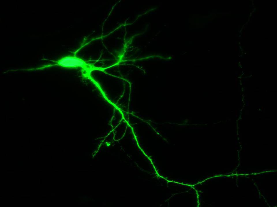 Primary Mouse Neurons in Adherence6