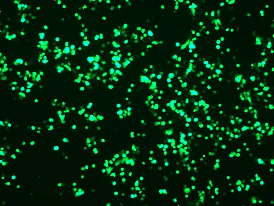 NEPA21 / RMG-1 - Human Ovarian Clear Cell Adenocarcinoma - Transfection Efficiency 67 per cent