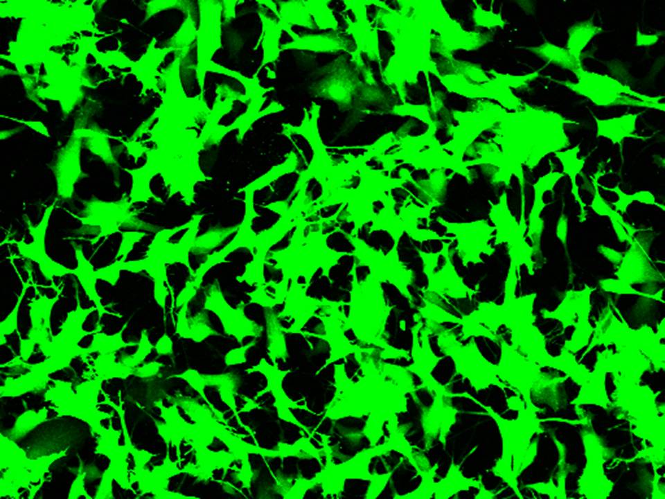 NEPA21 / SK-N-SH - Human Neuroblastoma cells - Transfection Efficiency 95 per cent