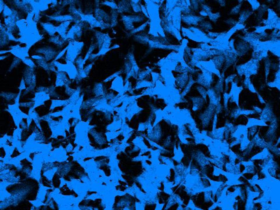 NEPA21 / SK-N-SH - Human Neuroblastoma cells - Viability 95 per cent
