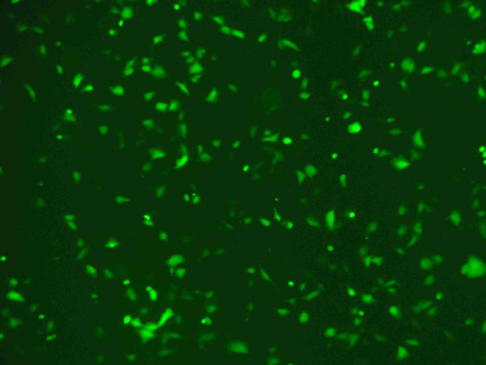 NEPA21 / SUSM-1 - Human Fibroblasts - Transfection Efficiency 71 per cent