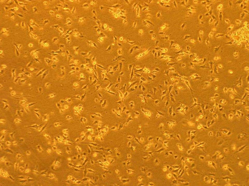 NEPA21 / SUSM-1 - Human Fibroblasts - Viability 77 per cent