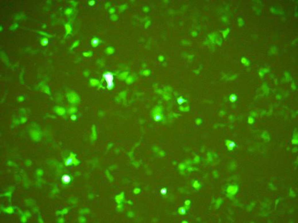 NEPA21 / TE-1 - Human Esophageal Carcinoma cells - Transfection Efficiency 41 per cent