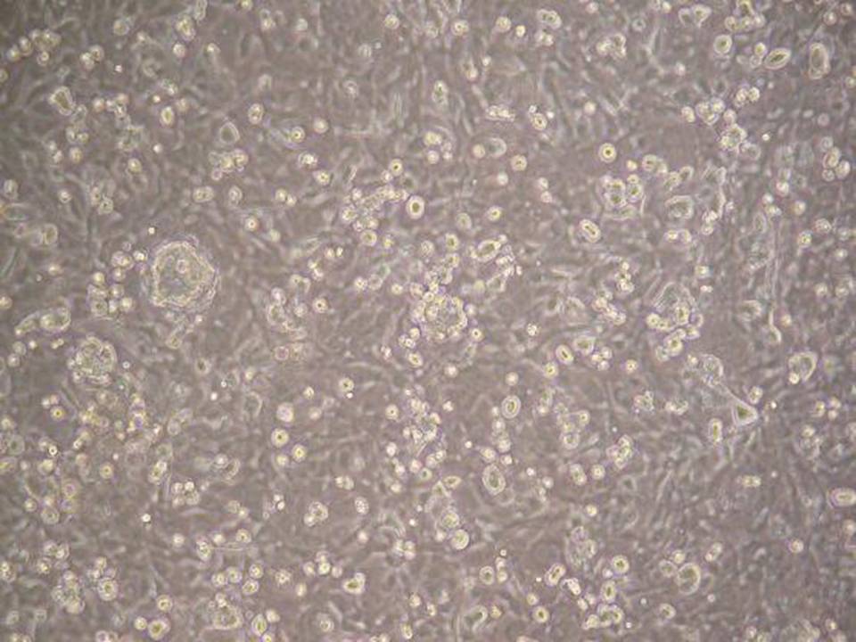 NEPA21 / TE-1 - Human Esophageal Carcinoma cells - Viability 85 per cent