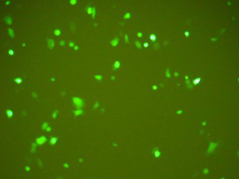 NEPA21 / TE-8 - Human Esophageal Carcinoma cells - Transfection Efficiency 40 per cent