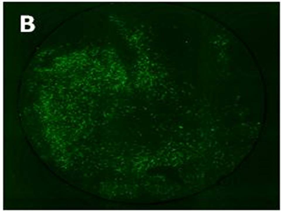 EGFP fluorescence image of the neurons 2 days after electroporation