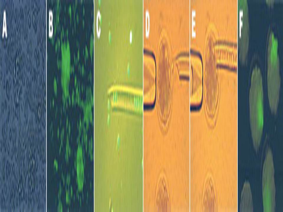 Expression of EGFP in transgenic chimeric embryos derived from ES-like cells jpg